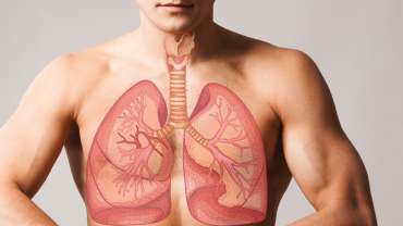 Critical Lung Disease 82 Critical Lung Disease