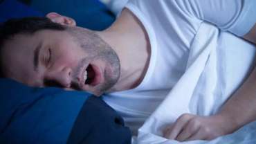 OSA (Obstructive Sleep Apnea) 67 OSA (Obstructive Sleep Apnea)