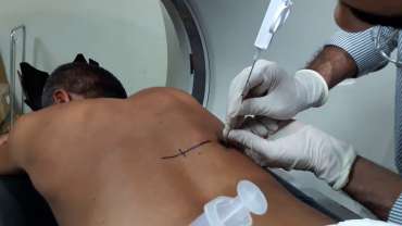 Pleural Biopsy 61 Pleural Biopsy