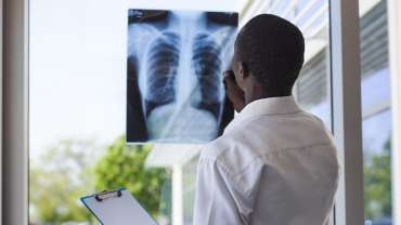Pulmonary Embolism 52 Pulmonary Embolism