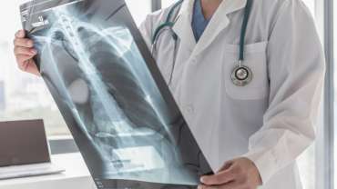 Pulmonary Hypertension 49 Pulmonary Hypertension