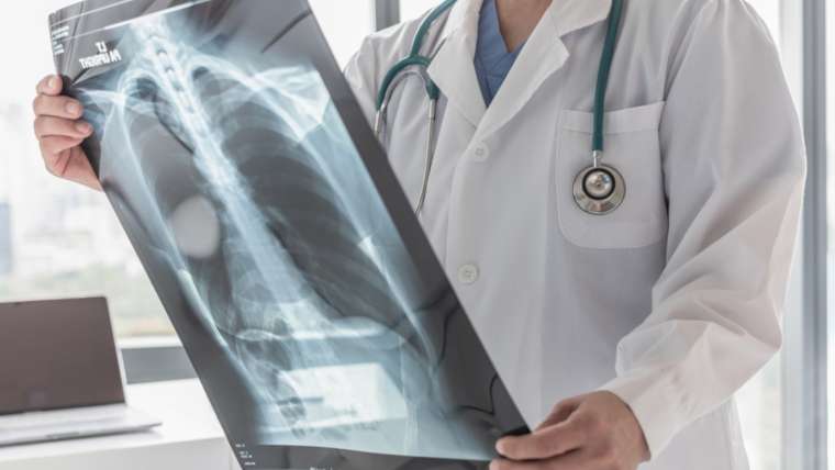 Pulmonary Hypertension 3 Pulmonary Hypertension