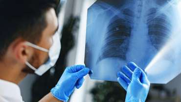 Lung Cancer