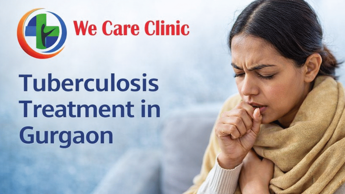 TUBERCULOSIS TREATMENT