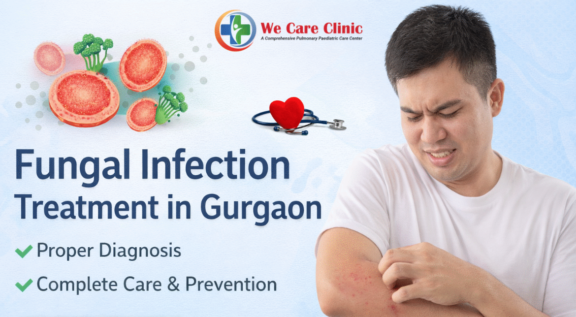 FUNGAL INFECTION TREATMENT